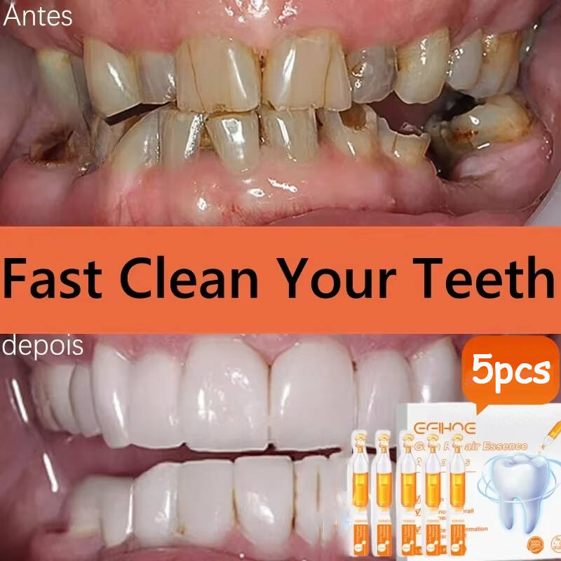 Teeth Whitening With Baking Soda - すぐに修復ガム血清後退する歯茎の再成長を和らげるドロップ歯を白くする黄色のプラークの汚れを除去虫歯歯痛歯磨き粉