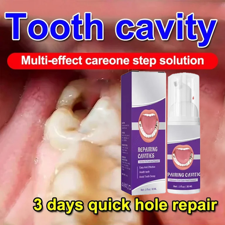 Teeth Whitening Gum - 歯のクリーニング 歯磨き粉 歯の汚れを除去 歯のホワイトニング 虫歯の修復 歯石プラーク