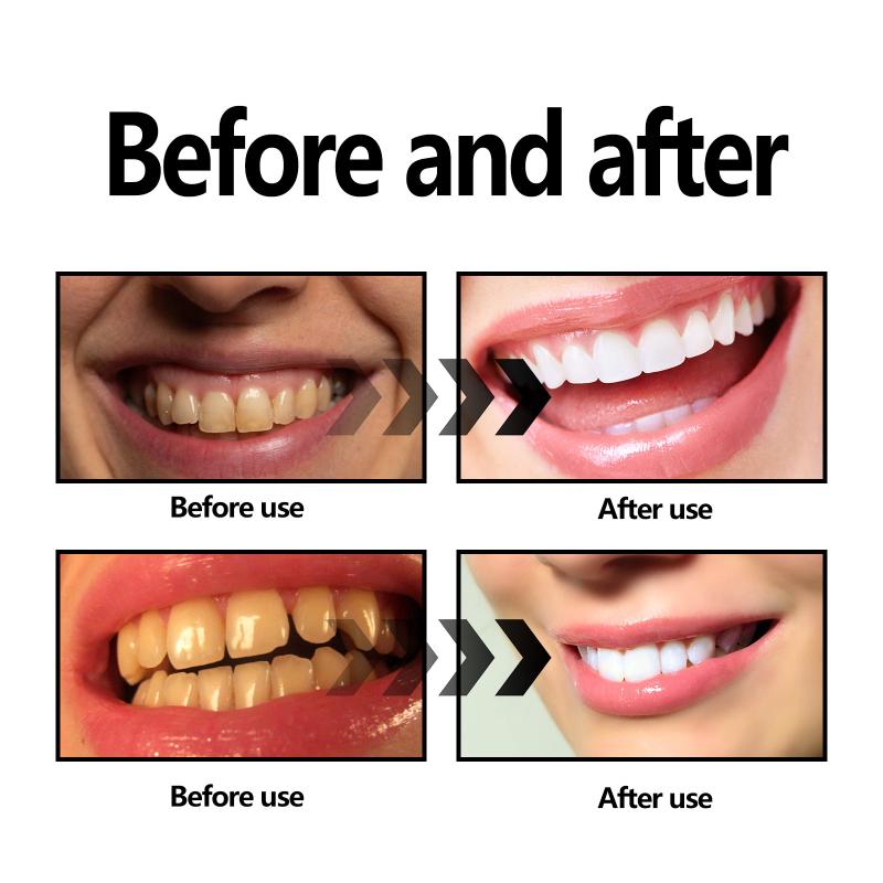 歯のホワイトニングパウダー チャコール/重曹歯のホワイトニン - Teeth Whitening With Baking Soda のレビューと価格