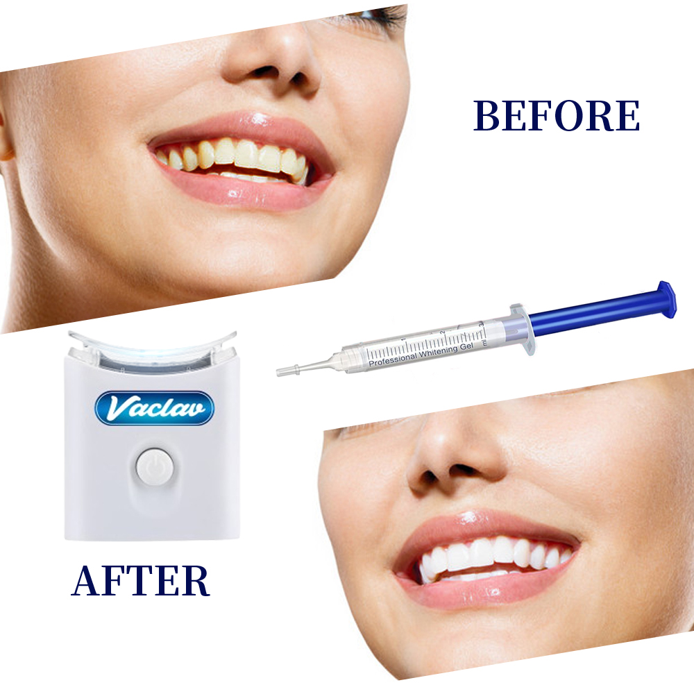ミント歯のホワイトニングジェルシリンジホーム歯のホワイトニン - Teeth Whitening With Baking Soda のレビューと価格
