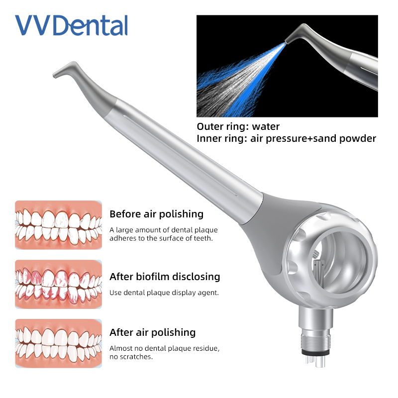 VV デンタル 2/4 穴歯ホワイトニングサンドブラストガン - Teeth Whitening Usa のレビューと価格