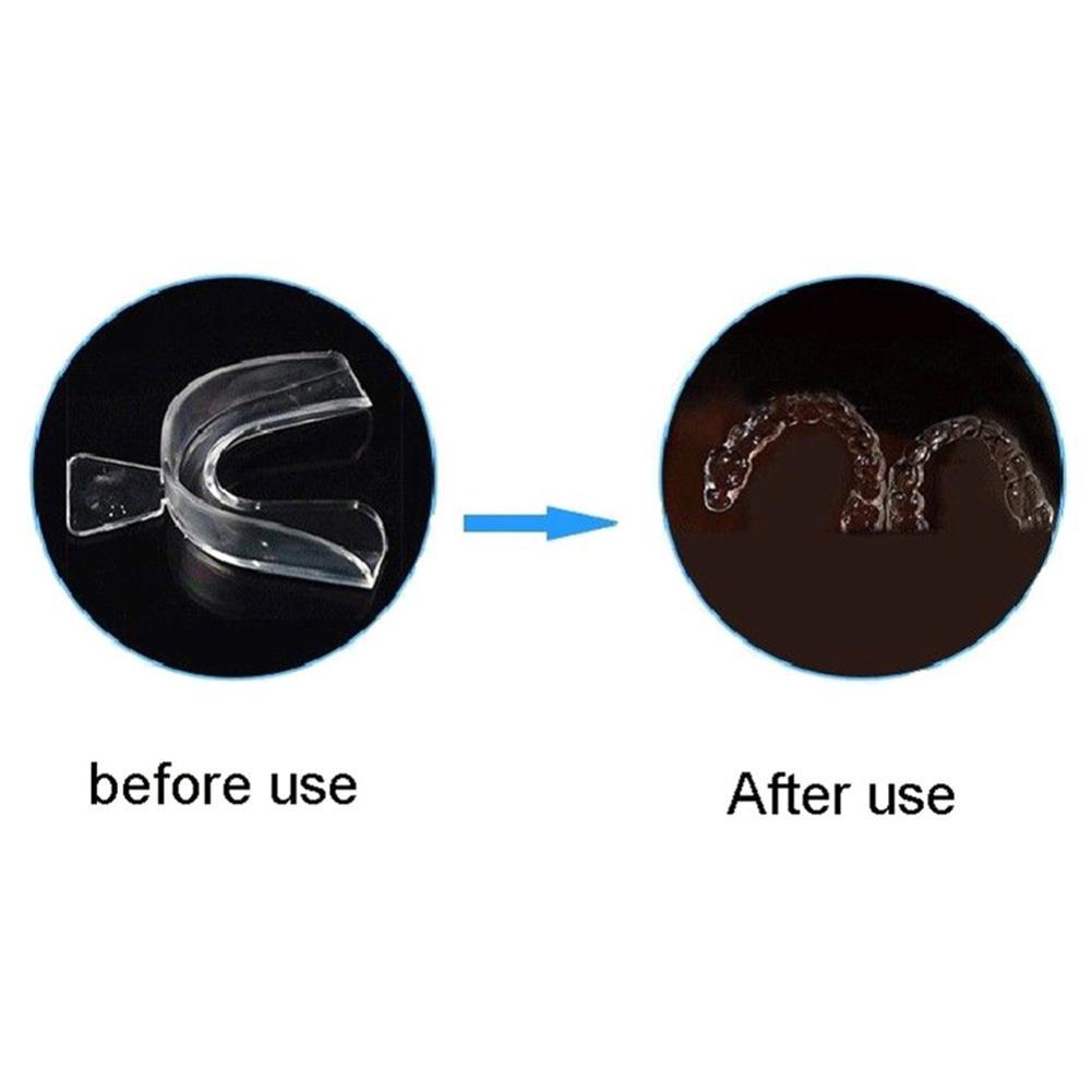 シリコン製マウスガード、歯列矯正用、歯の保持器、歯ぎしり防止 - Teeth Whitening For Trays のレビューと価格