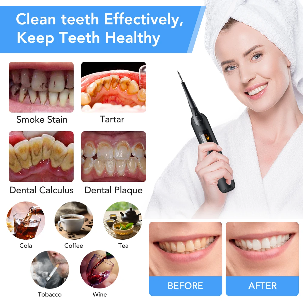 電動歯科スケーラー歯ブラシセット液晶画面 LED ライト歯科 - Teeth Whitening Or Tooth Whitening のレビューと価格