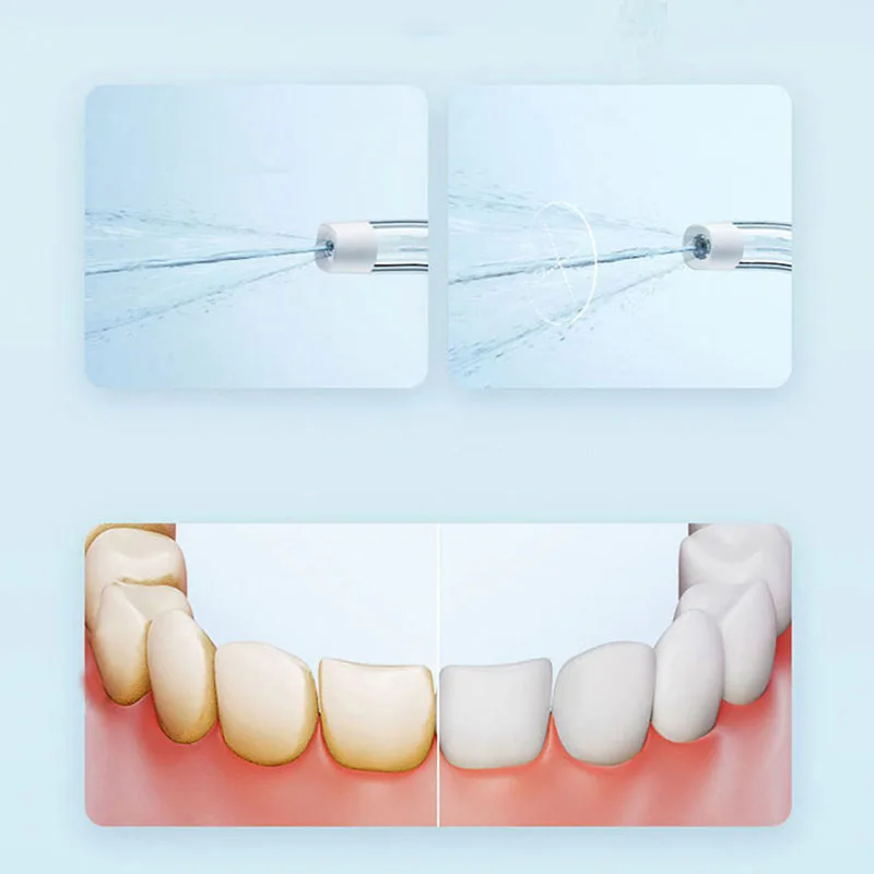 Xiaomi ポータブル口腔洗浄器 F300 歯科用ウォータ - Teeth Whitening Or Tooth Whitening のレビューと価格