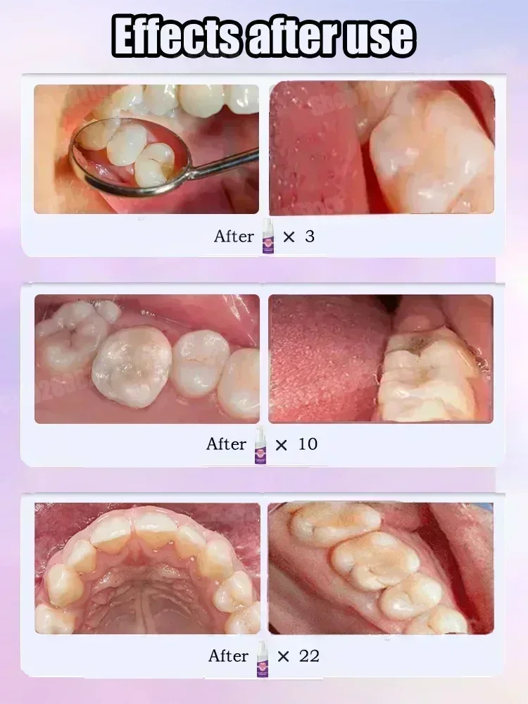 歯のクリーニング 歯磨き粉 歯の汚れを除去 歯のホワイトニン - Teeth Whitening Gum のレビューと価格