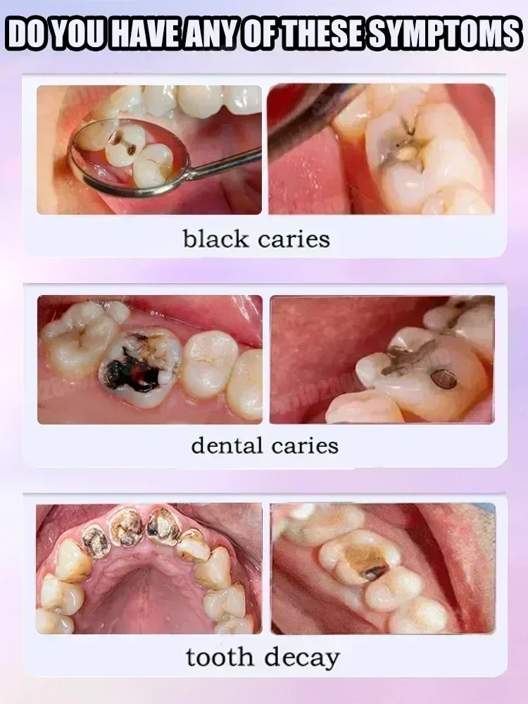 歯のクリーニング 歯磨き粉 歯の汚れを除去 歯のホワイトニン - Teeth Whitening Gum のレビューと価格