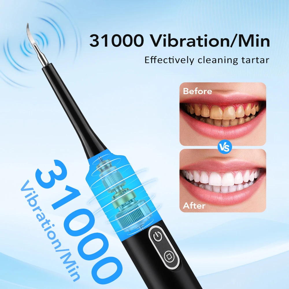 電気音波振動歯科用スケーラー歯のホワイトニング歯垢除去コーヒ - Teeth Whitening Professional のレビューと価格
